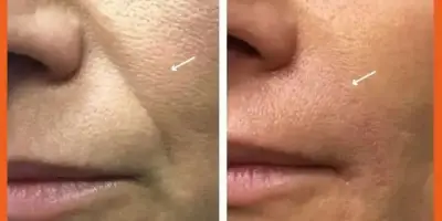 قیمت اندولیفت