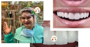 بهترین متخصص زیباسازی دندان در تهران